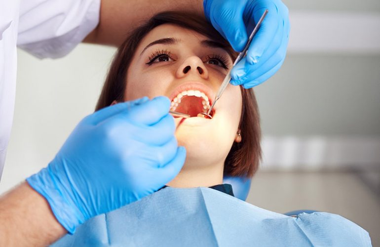 Diş Taşı Temizleme Sonrası Dikkat Edilmesi Gerekenler