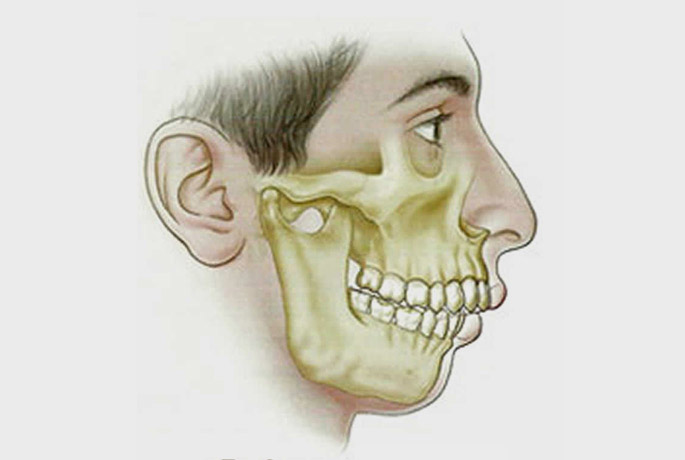 İskeletsel Ortodontik Tedavi