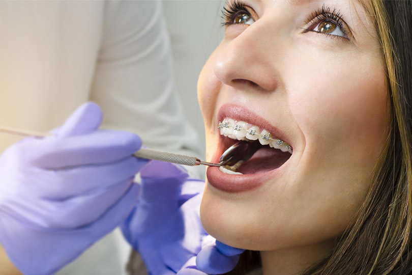Ortodonti Tedavisinde Dikkat Edilmesi Gereken 11 Nokta